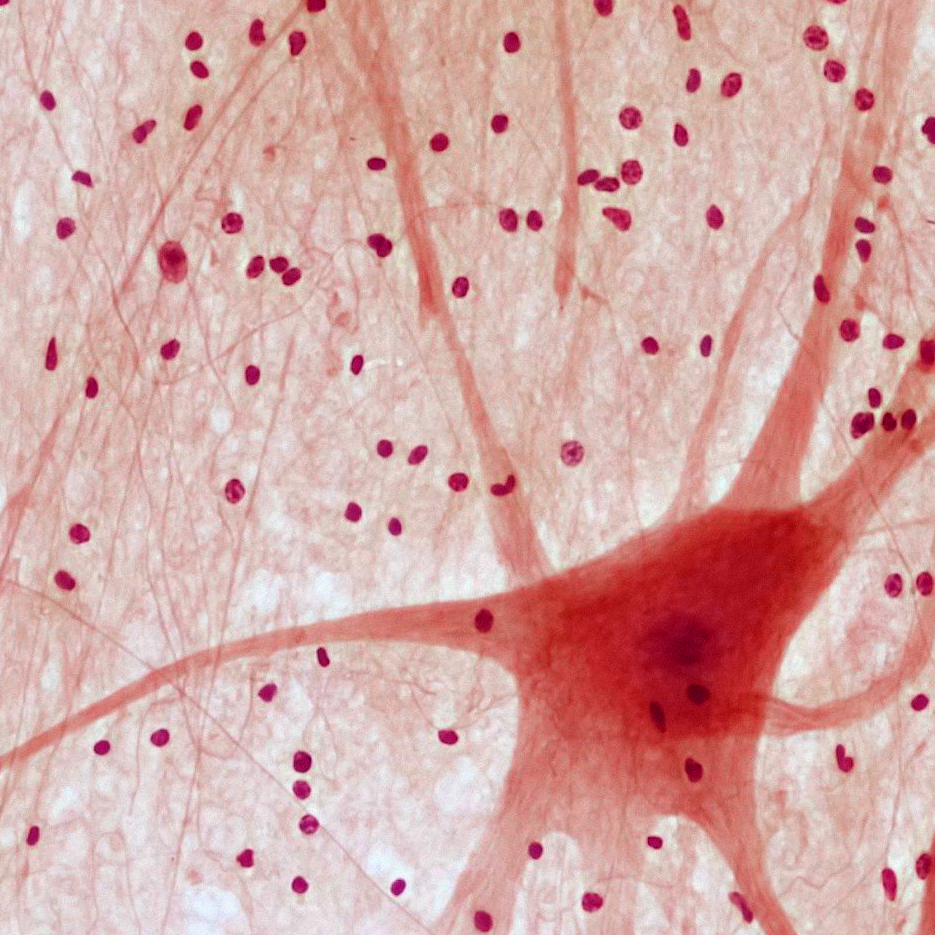 LENDARA CLINIC, la belleza es la consecuencia natural de un cuerpo en equilibrio Neurona en un fondo de tejido nervioso, con células y prolongaciones visibles.